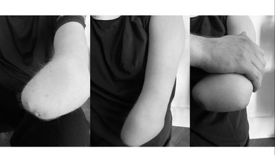 britisharmamputee2021 thumbnail