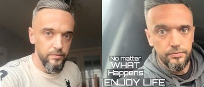 alexr1_1000cc thumbnail