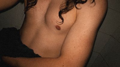 james-aloe thumbnail