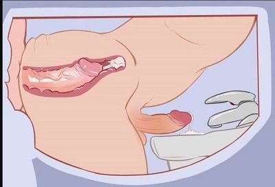 papilatin21 thumbnail