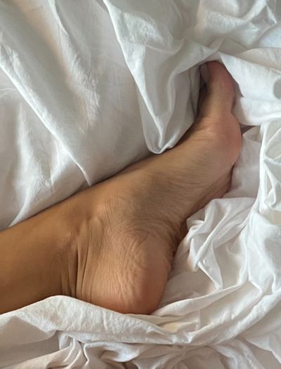 feetbirthmark profile