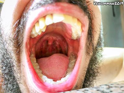 alexandervenom thumbnail