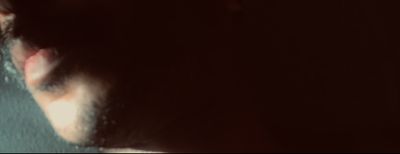 hairyblackbearded thumbnail