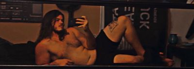 snake0bite thumbnail