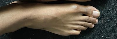 legendfeet thumbnail