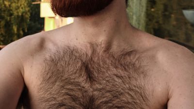 denthesiberianhairyguy thumbnail