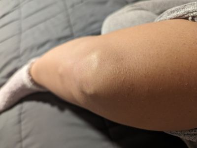 Knees to Know thumbnail