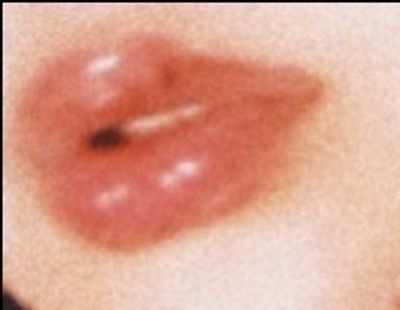 mess_ycanvas profile