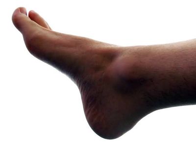 Foot thumbnail