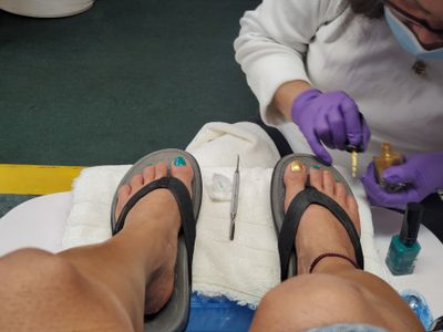 toeXXXotic thumbnail