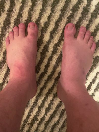 Flattest Feet profile