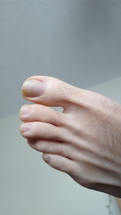 feetmehalfway profile