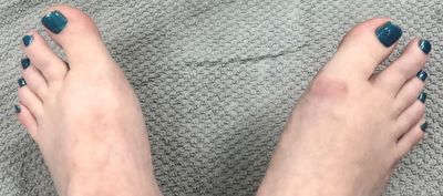 crimsonvixen77 thumbnail