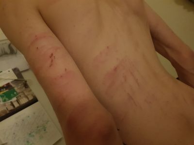 MikkiBones thumbnail