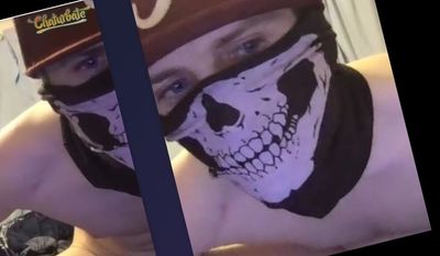 spottedcock1 thumbnail