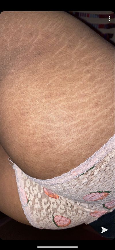 nabraialexis thumbnail