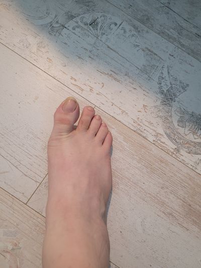 Benton Terrontino thumbnail