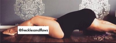 frecklesandflaws thumbnail