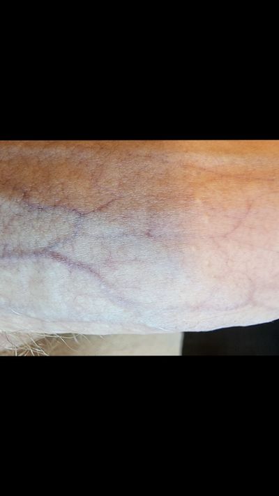 Chris Haydock thumbnail