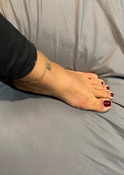 Candy Foot thumbnail