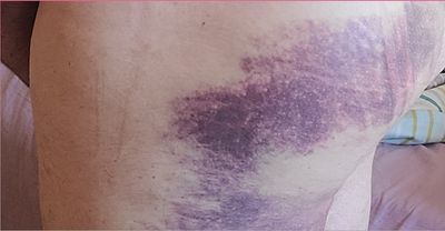 dadbodspits thumbnail