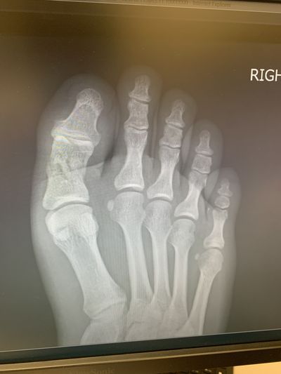 motelekres thumbnail