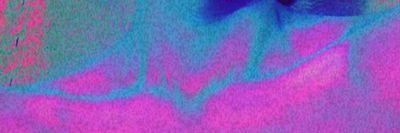 sertralinepapi thumbnail